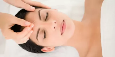 facial rejuvenation acupuncture